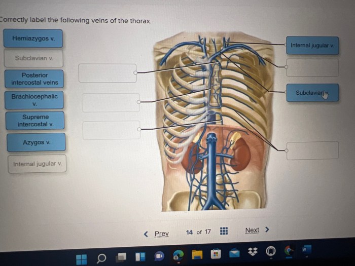 Correctly label the following veins of the thorax.