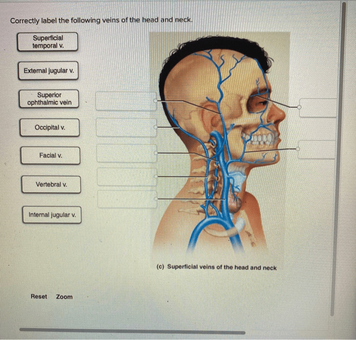 Veins abdomen correctly solved pelvic transcribed